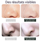 Aspirateur Point Noir 600mah électrique 30w pixels Ecran visuel LED Sélection de trois vitesses Aspirateur Point Noir électrique