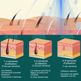 Épilateur électrique femme usb Intensité réglable lames en acier inoxydable corps en ABS épilateur wet et dry pour tout le corps
