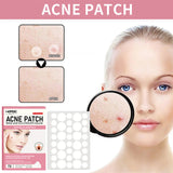 Patch d'acné invisible, patch de marque d'acné, correcteur naturel d'élimination de l'acné, patch d'acné, patch hydrocolloïde