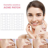 Patch d'acné invisible, patch de marque d'acné, correcteur naturel d'élimination de l'acné, patch d'acné, patch hydrocolloïde