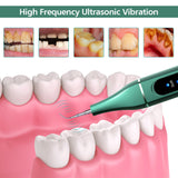 Modern Portable Electric Ultrasonic Teeth Cleaner Smart Teeth Cleaning Remove Cigarette Stains Clean Mouth Fresh Breath