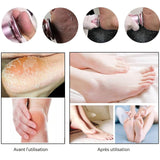 Rapeuse pieds electrique rechargeable anti-callosités râpe à pieds pédicure electrique vitesse réglable lime pieds electrique