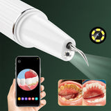Nettoyeur de dents à ultrasons   3 vitesses réglables    Soins dentaires   Nettoyage visuel des dents  Détartreur électrique