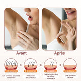 Épilateur lumière 15J avec technologie de refroidissement saphir 5 niveaux d'énergie épilateur femme epilateur lumière pulsée