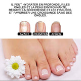 Solution de renouvellement des ongles 3 pcs 10ml spray de antifongique traitement antifongique protège de décoloration et fissuré