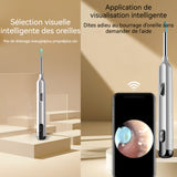 Otoscope oreille 3 millions de pixels distance focale 12-15 mm avec accessoires 8 pièces autonomie de la batterie 50 minutes blanc