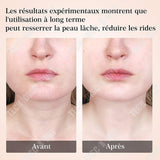 TD® Instrument de beauté raffermissant la peau décolleté éclaircissant anti-rides masseur d'importation chaude et froide