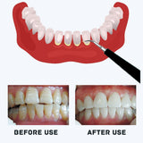 TD® Détartreur dentaire dissolvant de calculs outil de soins dentaires tête de nettoyage remplaçable électrique détartreur dentaire